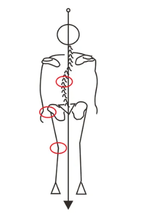 科学干预孩子长短脚，不妨将目光投向矫正鞋及鞋垫
